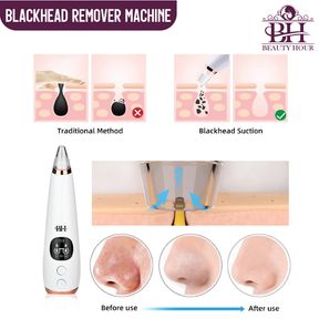 Derma Suction Blackhead Remover