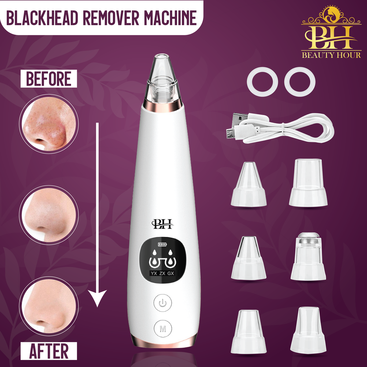 Derma Suction Blackhead Remover